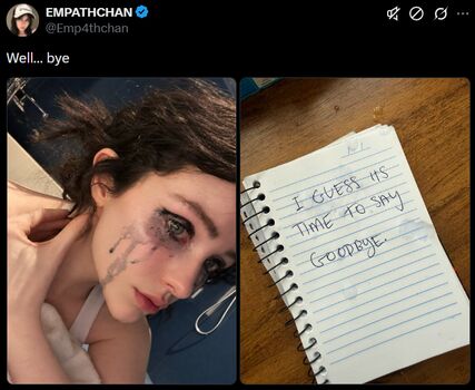 Empathchan leaked private photo uncensored HD quality