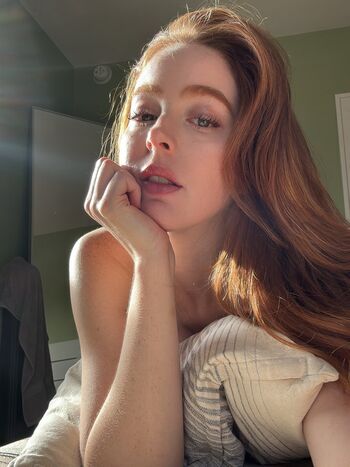 Erna burn  page leaked private photo uncensored HD quality