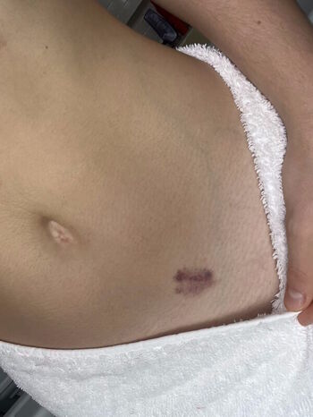 Lorde  page leaked private photo uncensored HD quality