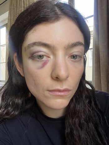Lorde  page leaked private photo uncensored HD quality